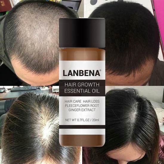 LANBENA Hair Growth Essence Liquid Care Active Hair Follicle Hair Loss Treatment 20ml