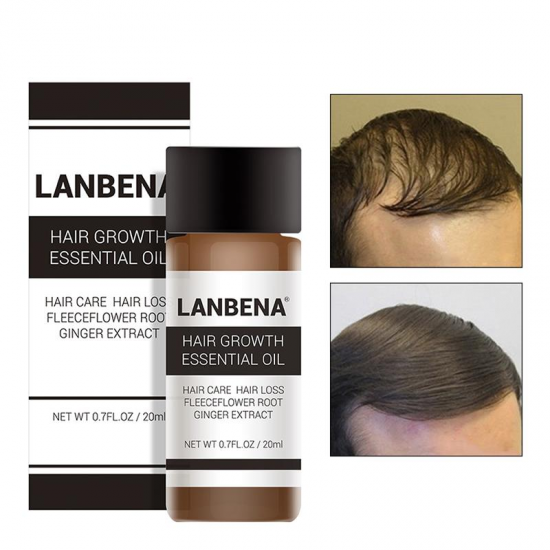 LANBENA Hair Growth Essence Liquid Care Active Hair Follicle Hair Loss Treatment 20ml