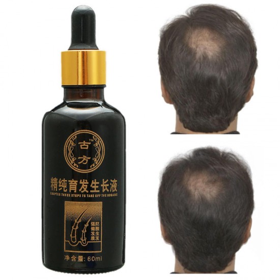 Shedding Proof Herbal Extract Liquid Hair Growth Anti Hair Loss Men Women Follicle Activating Repair