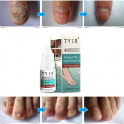 10ML Fungal Nail Treatment Nail Nutrient Solution Repair Nail Moisturizing Nail Care Tool 10ML Fungal Nail Treatment Nail Nutrient Solution Repair Nail Moisturizing Nail Care Tool