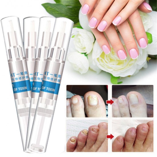 4Pcs Biological Toenail Fungus Stop Pencil Anti Fungal Nail Treatment Toenails Fingernail