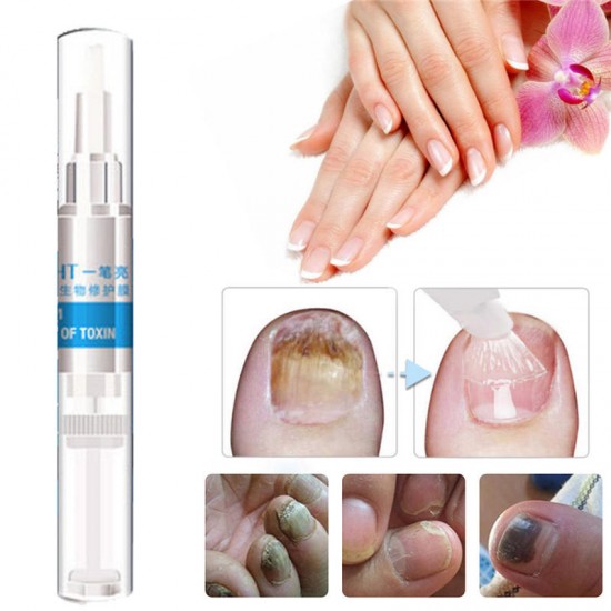 4Pcs Biological Toenail Fungus Stop Pencil Anti Fungal Nail Treatment Toenails Fingernail