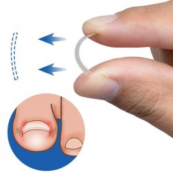 Ingrown Toenail Straightening Clip Curved BS Brace Toenails Thick Paronychia Correction Tool Ingrown Toenail Straightening Clip Curved BS Brace Toenails Thick Paronychia Correction Tool