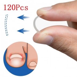 Ingrown Toenail Straightening Clip Curved BS Brace Toenails Thick Paronychia Correction Tool About 120Pcs Ingrown Toenail Straightening Clip Curved BS Brace Toenails Thick Paronychia Correction Tool About 120Pcs