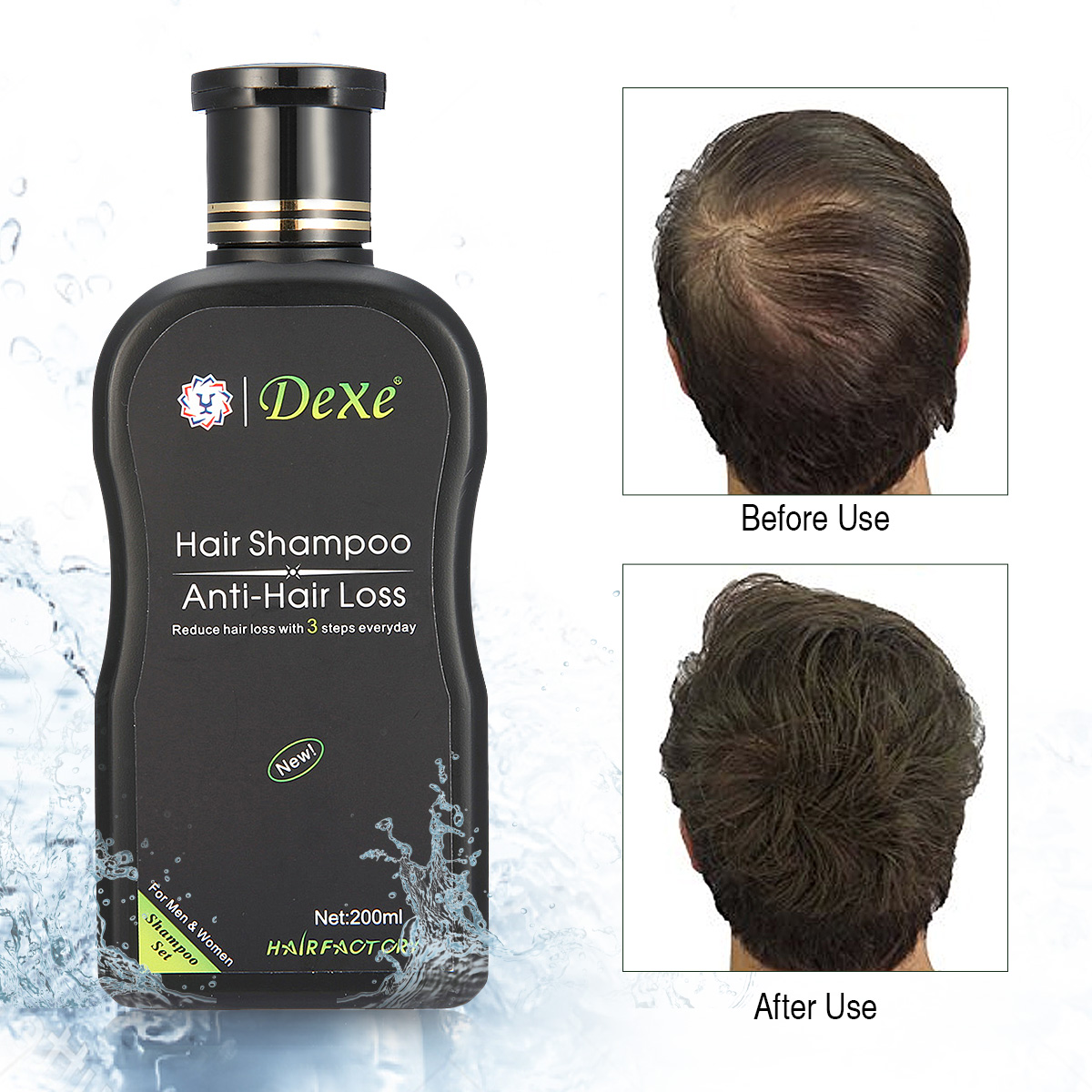 DEXE-200ml-Anti-Hair-Loss-Hair-Growth-Shampoo-Treatment-Natural-Ingredients-1254152