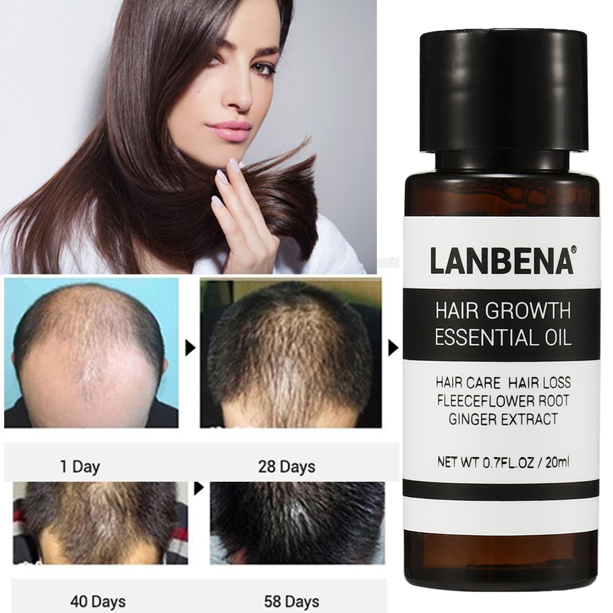 Fast-Powerful-Hair-Growth-Essence-Oil-Treatment-Anti-Hair-Loss-Hair-Care-1373020