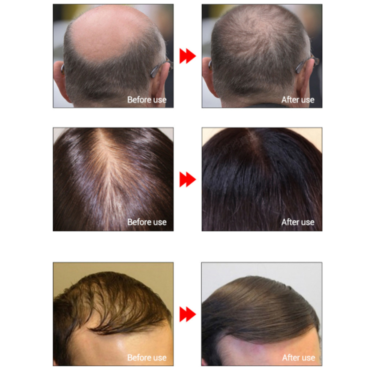 Fast-Powerful-Hair-Growth-Essence-Oil-Treatment-Anti-Hair-Loss-Hair-Care-1373020