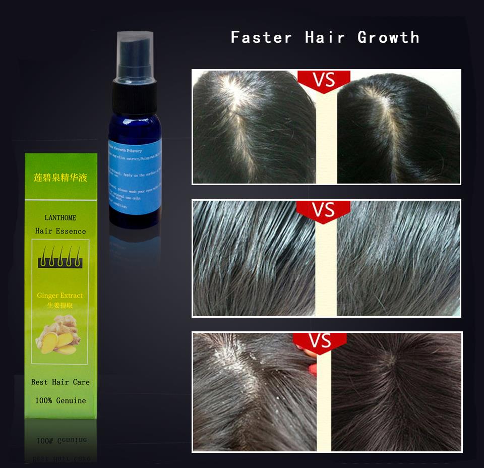 Lanthome-Chinese-Herbal-Fast-Hair-Growth-Essence-Liquid-Anti-Hair-Loss-Treatment-Pilatory-Sprayer-1177179