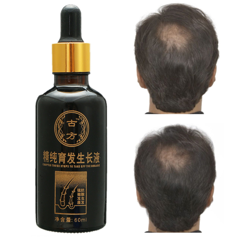 Shedding-Proof-Herbal-Extract-Liquid-Hair-Growth-Anti-Hair-Loss-Men-Women-Follicle-Activating-Repair-1142226