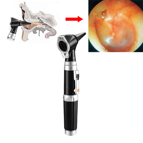 Pen-Style-Professional-Ear-Care-Otoscope-Auriscope-Diagnostic-Set-960754