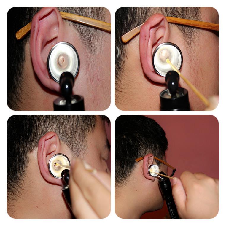 Portable-LED-Diagnostic-Otoscope-Ear-Canal-Pick-Cleaning-Earpick-Mirror-Pen-Lamp-1111325