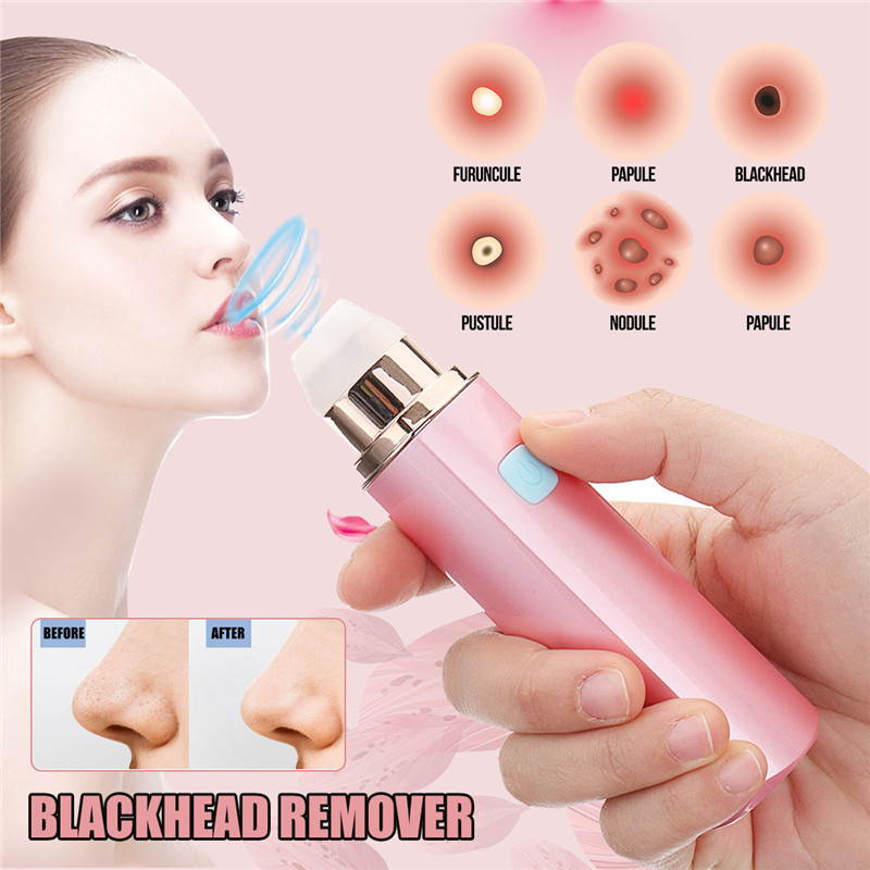 Electric-Skin-Facial-Pore-Spot-Suction-Remover-Blackhead-Vacuum-Acne-Cleaner-1415586