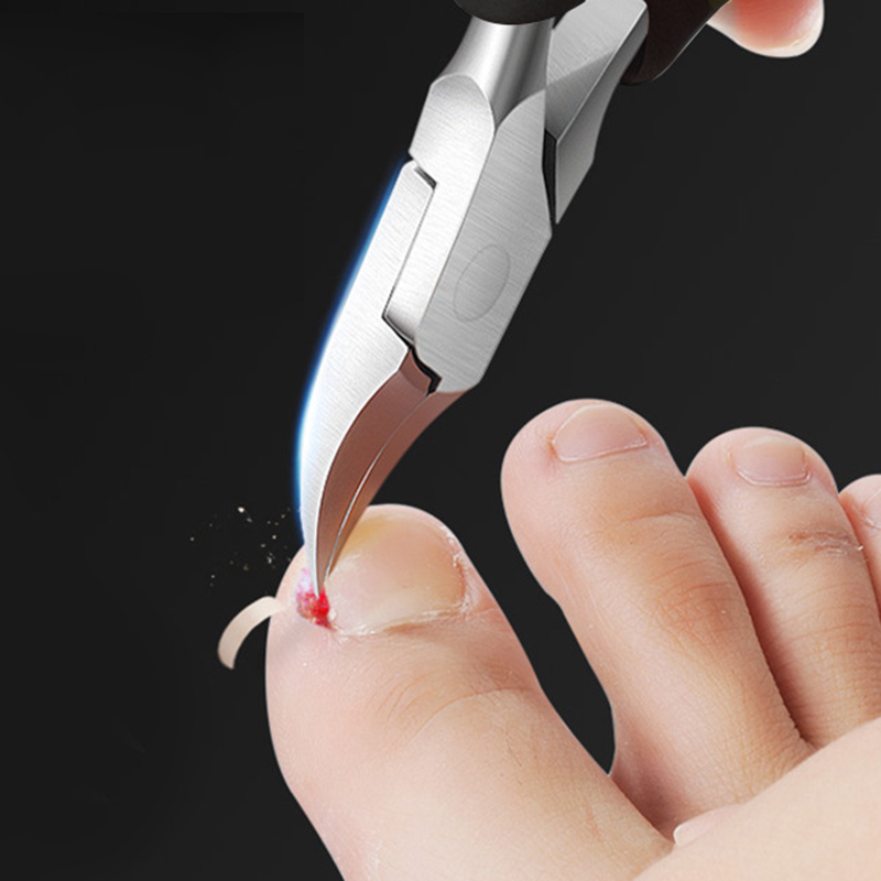 2-In-1-Ingrown-Toenail-Nipper-Nails-Clipper-Nail-Lifter-Kit-Paronychia-Care-Manicure-Pedicure-Tools-1288000