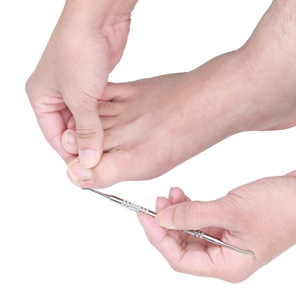 2pcs-Toenail-Paronychia-Correction-Cleaner-Nail-Nipper-Ingrown-Pedicure-Manicure-Tools-1085298