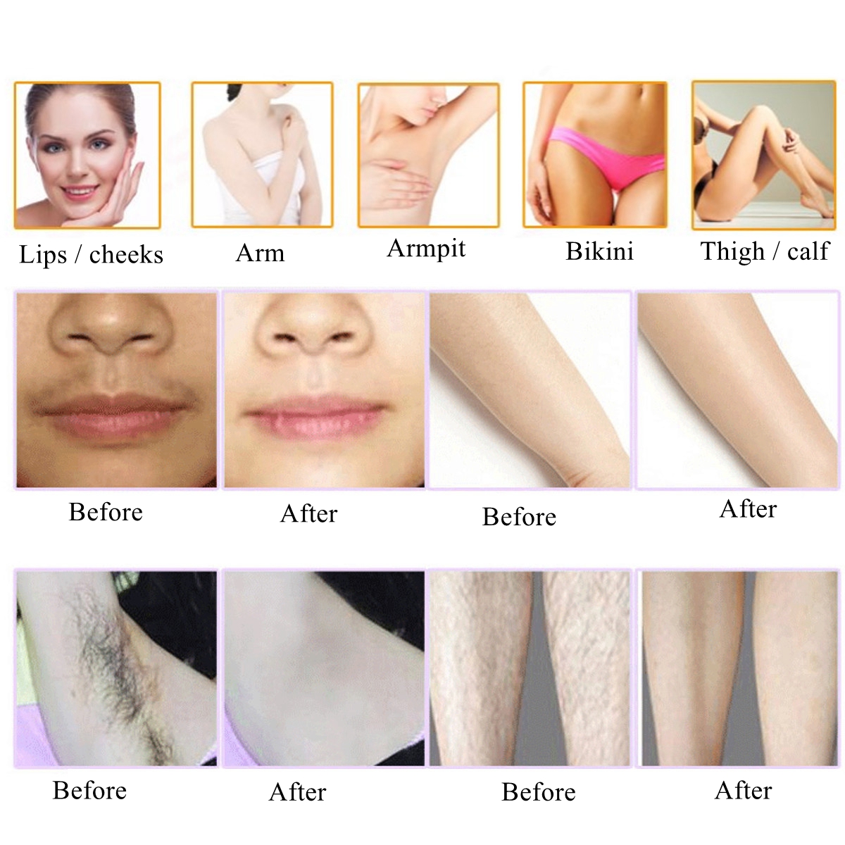 100000-Times-Lamp-IPL-Professional-Laser-Hair-Removal-Home-Use-Permanent-Epilator-Machine-1150686