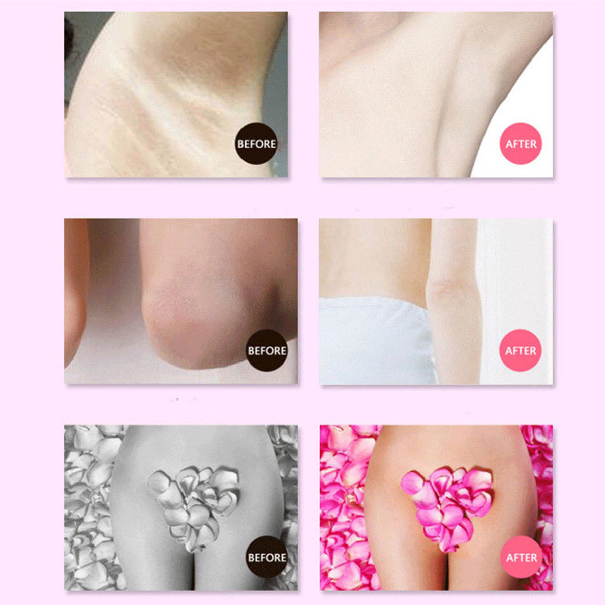1Pc-Beauty-Body-Armpit-Whitening-Cream-Between-Legs-Knees-Private-Parts-Intimate-1314310