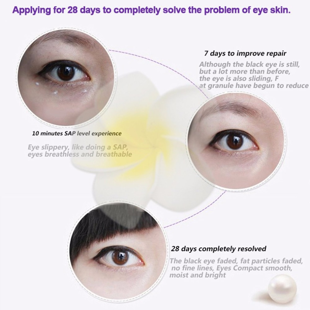 10ml-Eye-Essence-Repair-Eye-Ball-Cream-Dark-Circle-Moisturizing-1261289