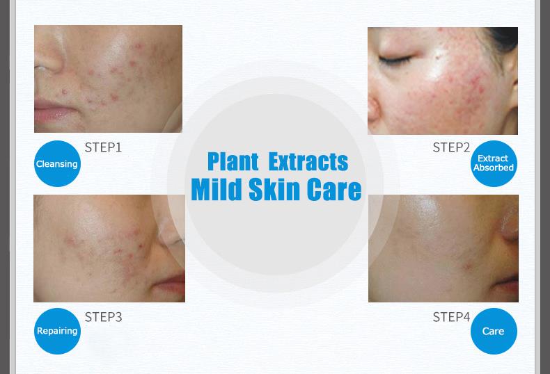 BIOAQUA-Acne-Treatment-Cream-Facial-Scar-Mark-Lightning-Oil-Control-Shrink-Pores-Moisturizer-1012839