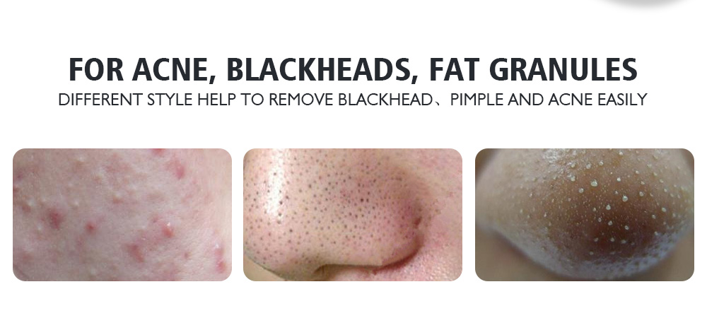 YFMreg-4pcs-Acne-Blackhead-Remover-Needles-Set-Rose-Gold-Double-Head-Pimples-Multipurpose-Cleansing--1112691